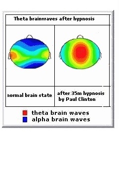 diagram to compare brain waves click for more info